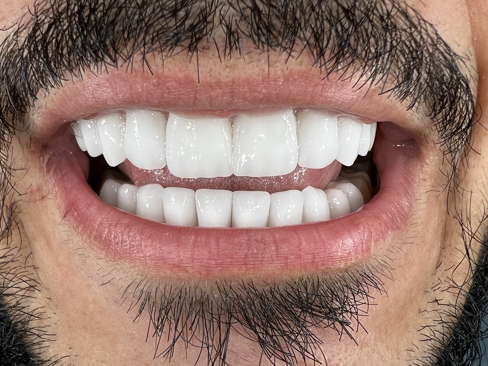 Klinike Dentare Vlore "Tozaj"