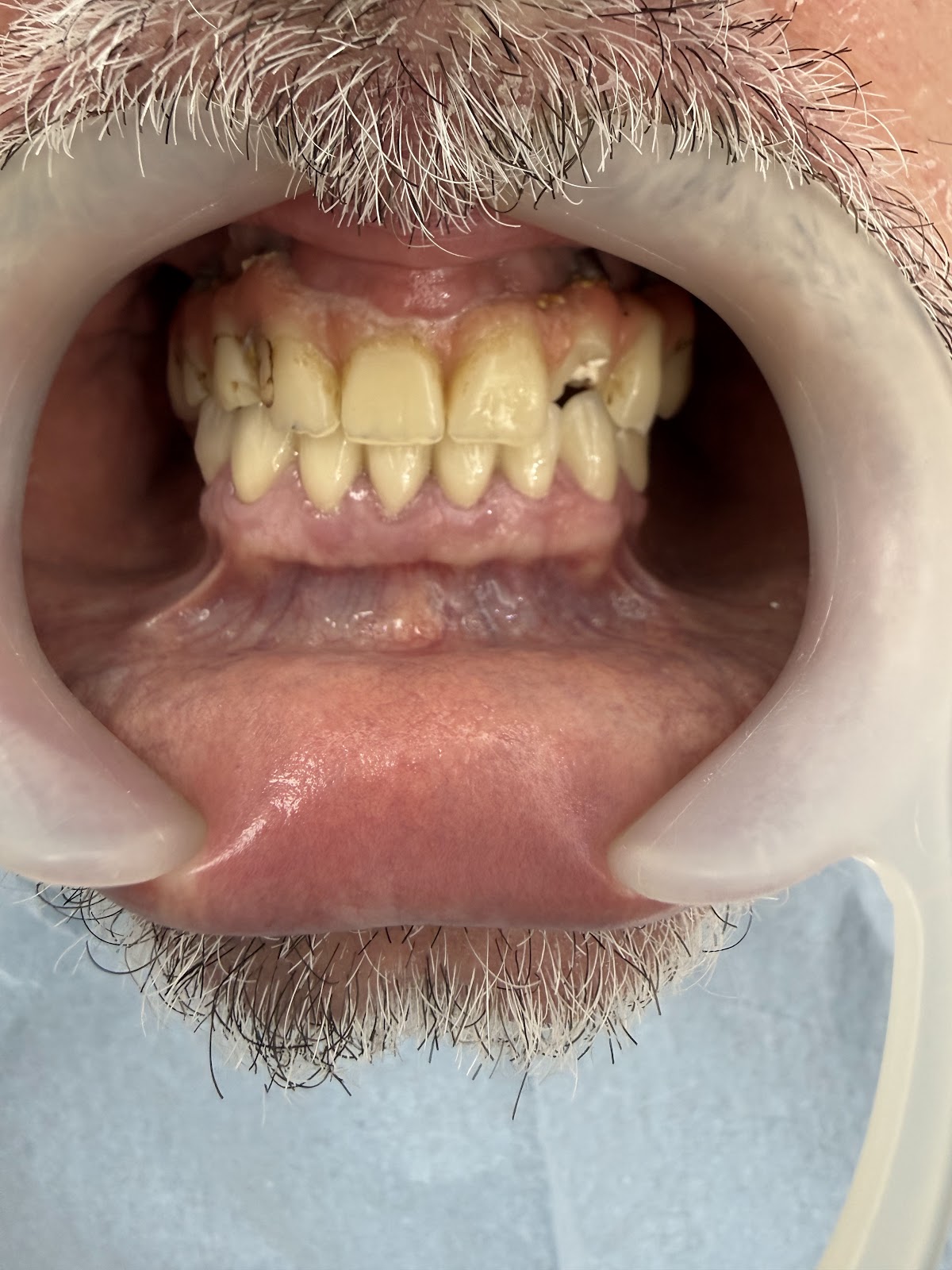 Klinike Dentare Vlore "Tozaj"