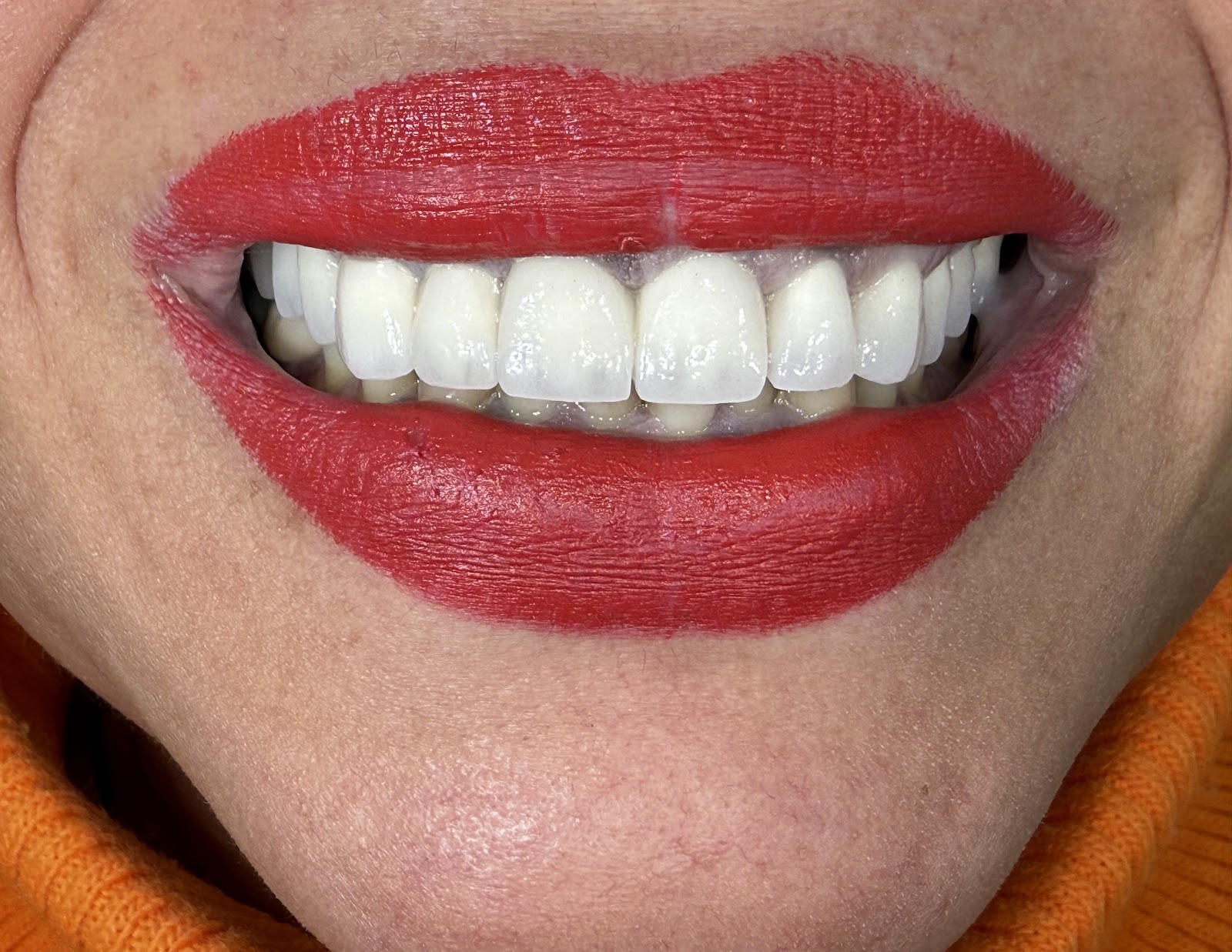 Klinike Dentare Vlore "Tozaj"