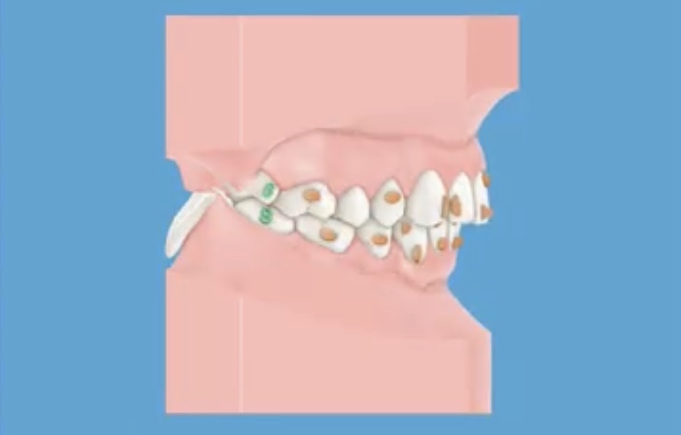 Clarus Dental