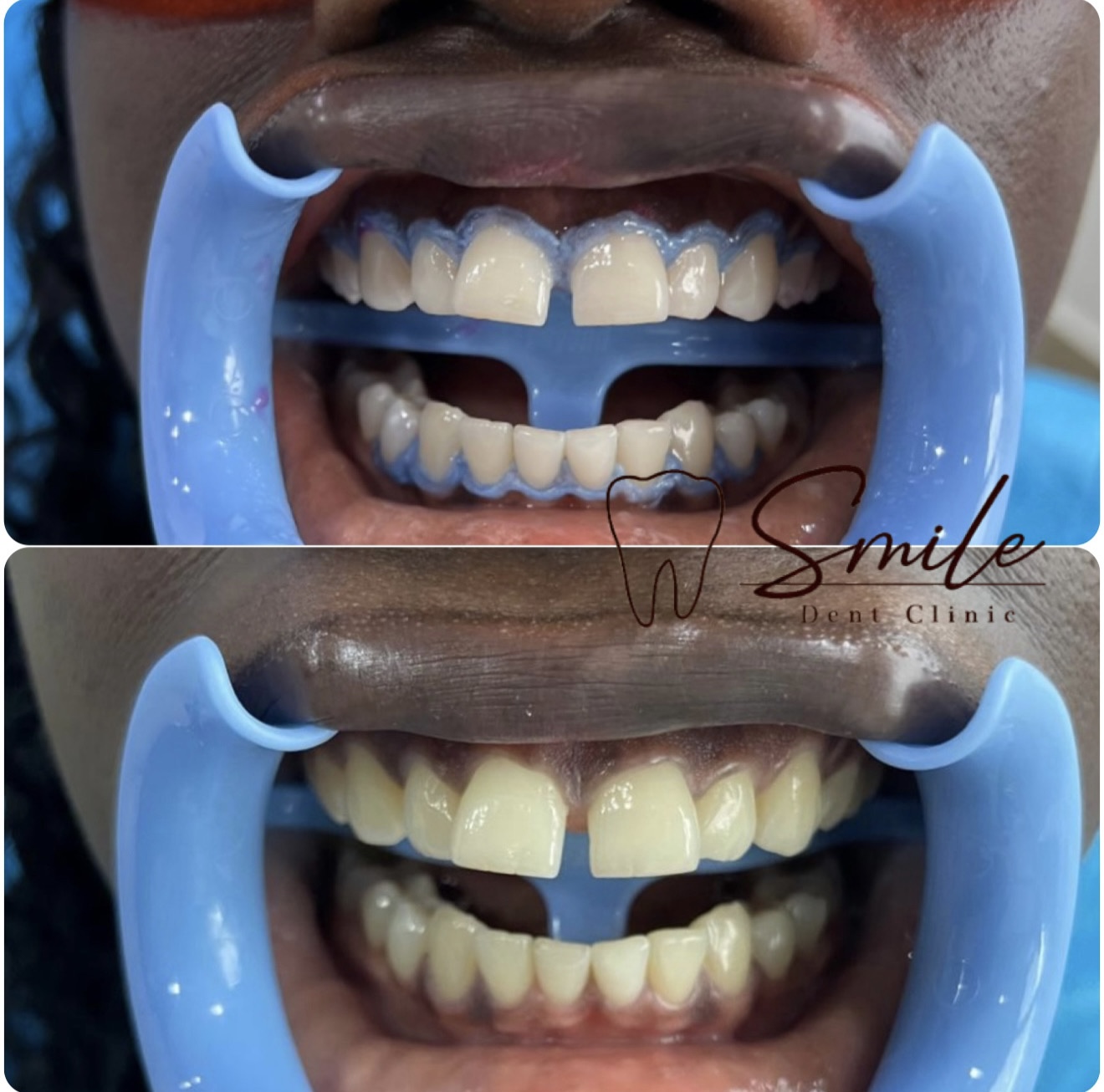 Smile Dent Clinic