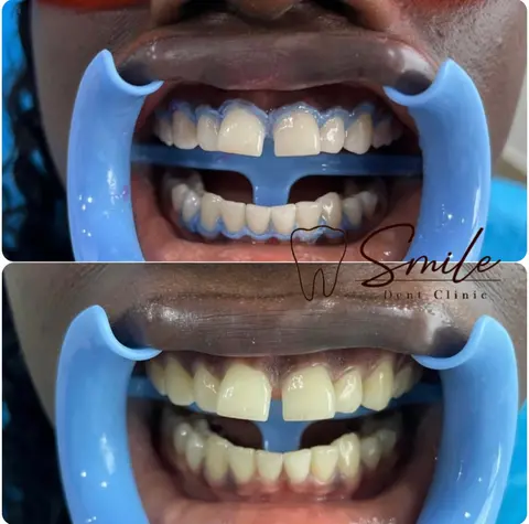 Smile Dent Clinic