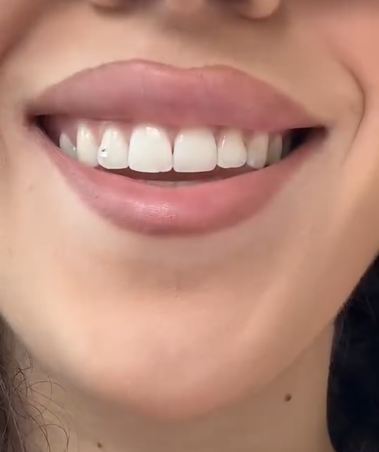 Odonto Derma | Klinikë Dentare & Estetike