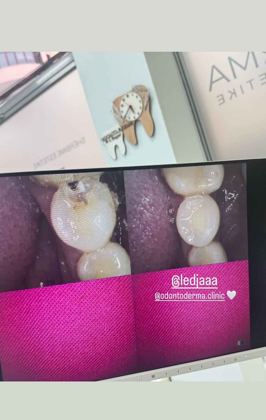 Odonto Derma | Klinikë Dentare & Estetike