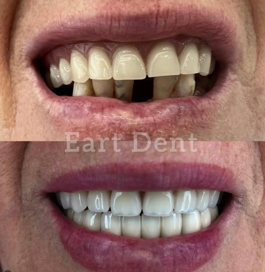 Klinike Dentare Durres - Eart Dent