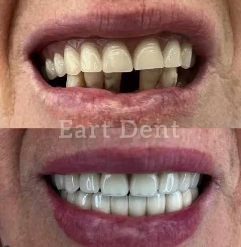 Klinike Dentare Durres - Eart Dent