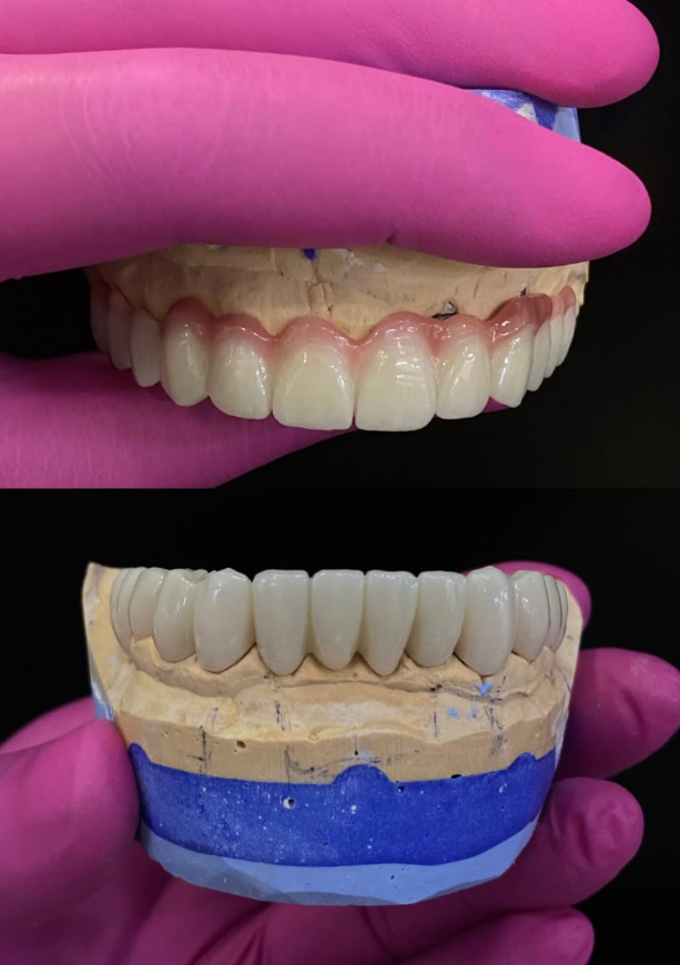 Klinike Dentare Durres - Eart Dent