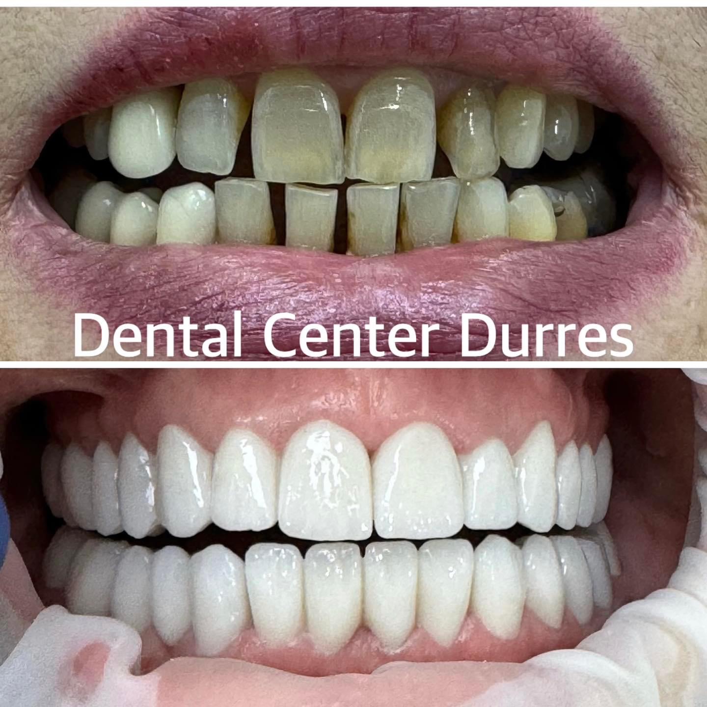 Dental Center Durres