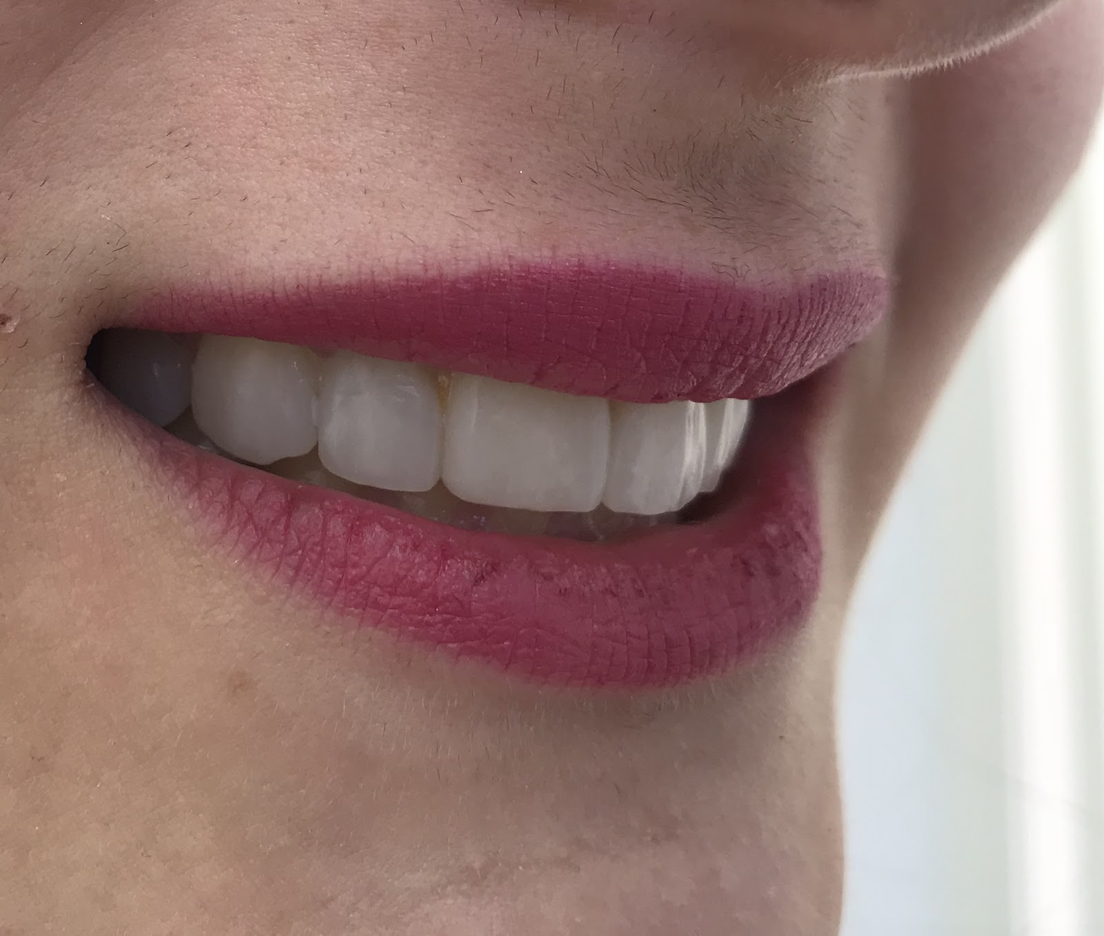 Dental Center Durres
