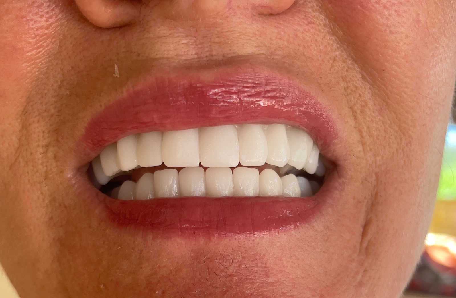 Dental Health