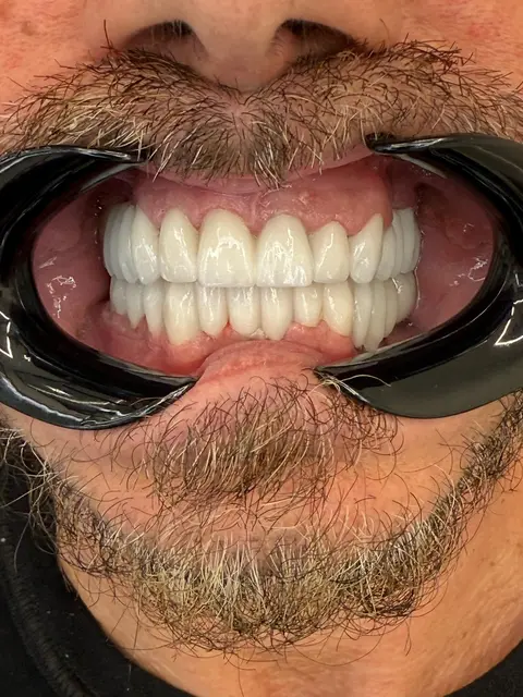 "LELA DENTAL" Dr.Shk.Fatmir Lela