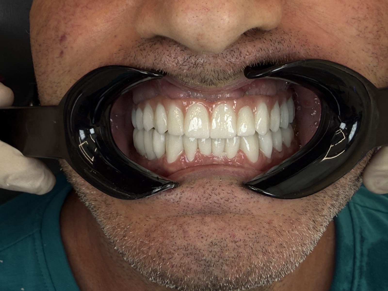 "LELA DENTAL" Dr.Shk.Fatmir Lela