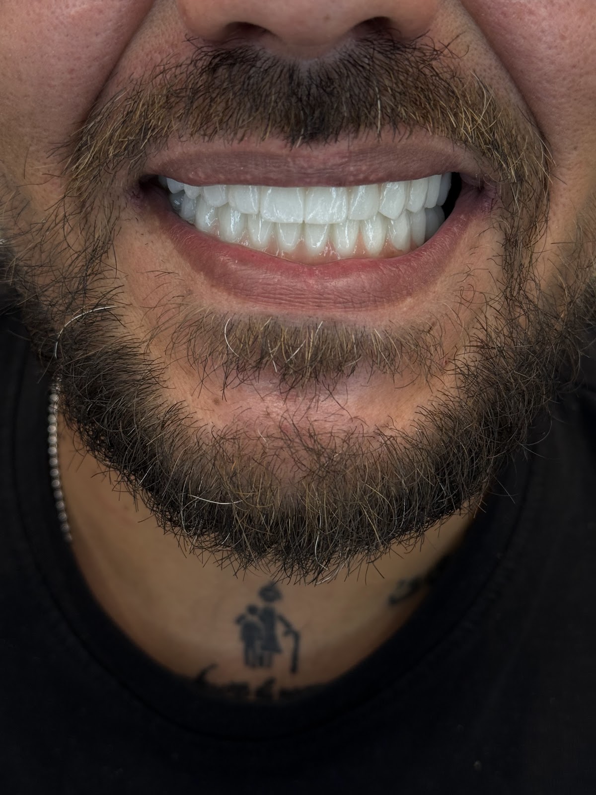 "LELA DENTAL" Dr.Shk.Fatmir Lela