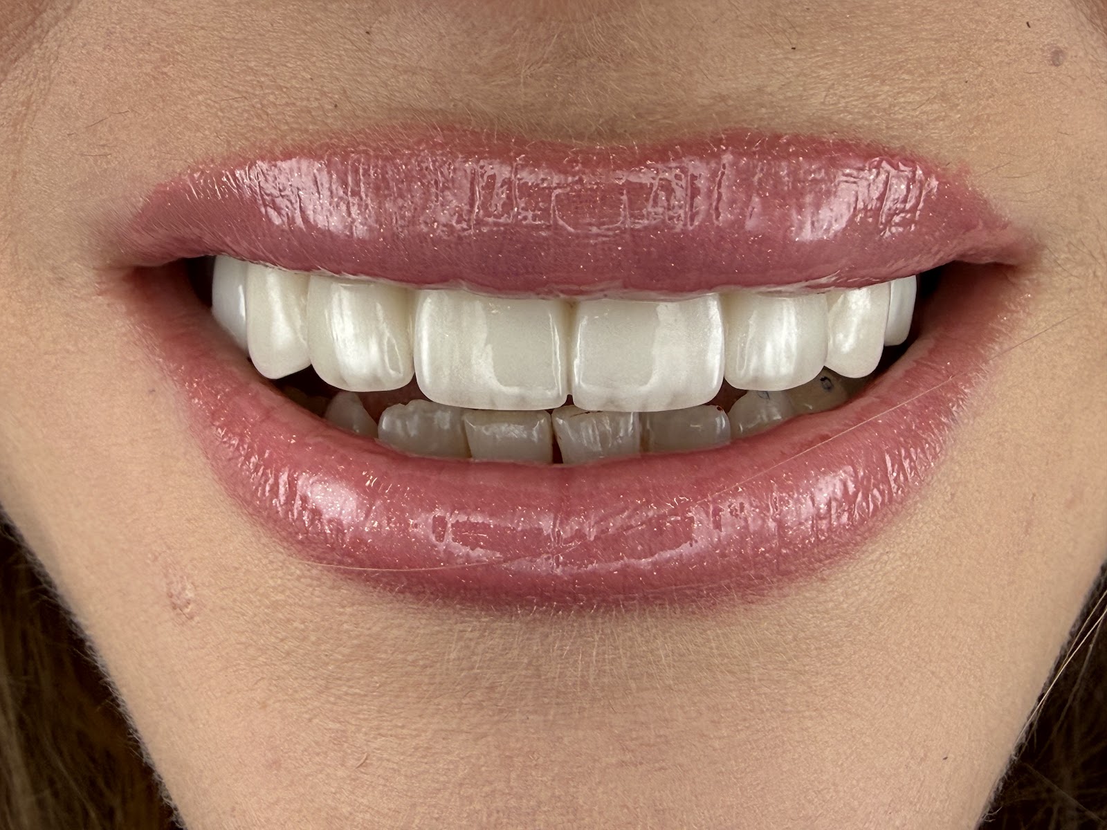 Dental Center Albania