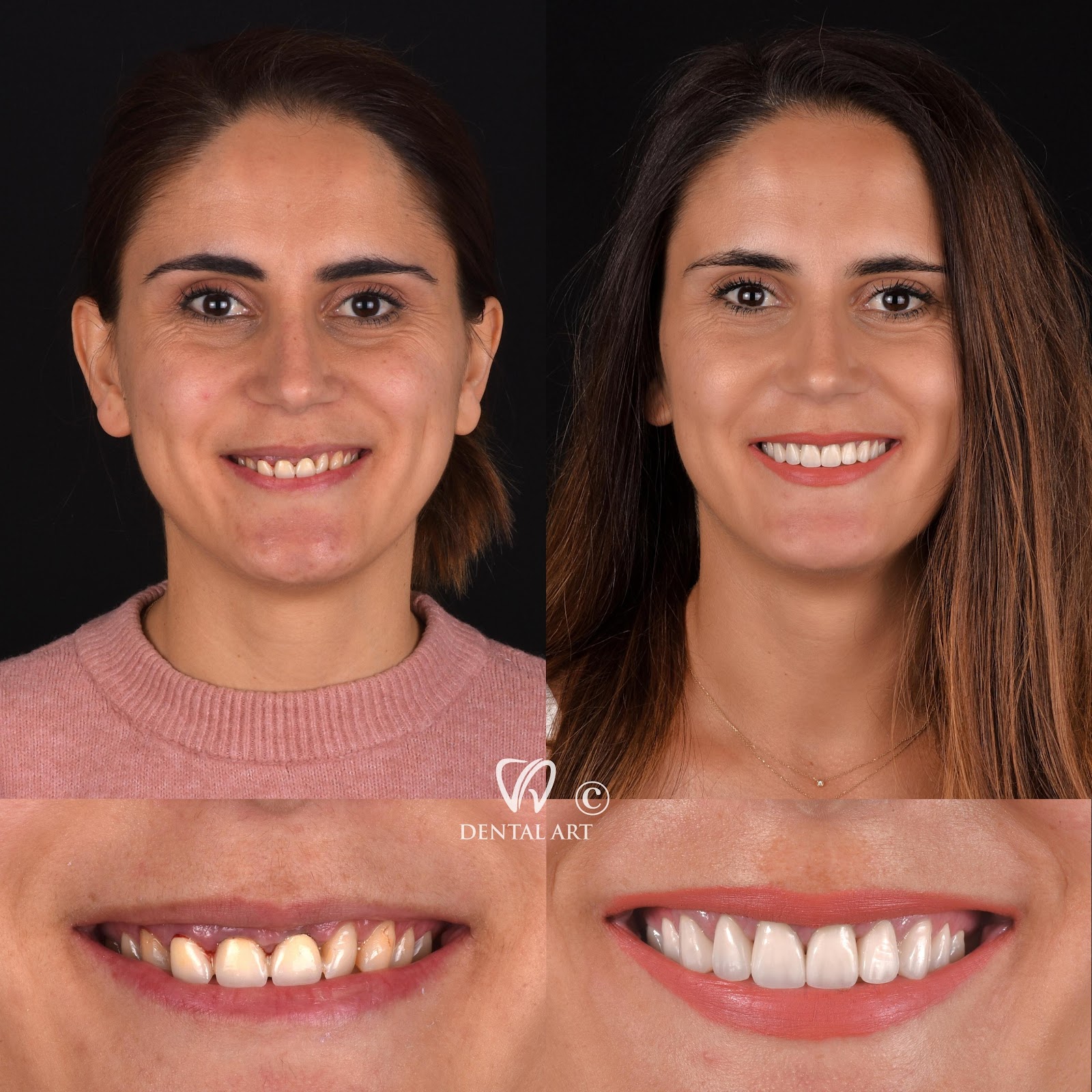 Dental Art Tirana (Dr. Elda Leka Kalemi)