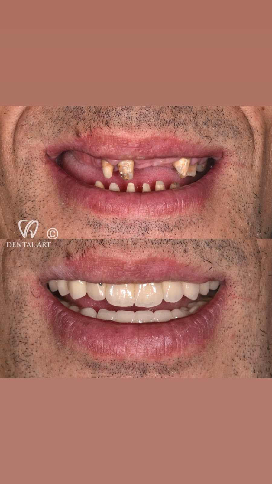 Dental Art Tirana (Dr. Elda Leka Kalemi)