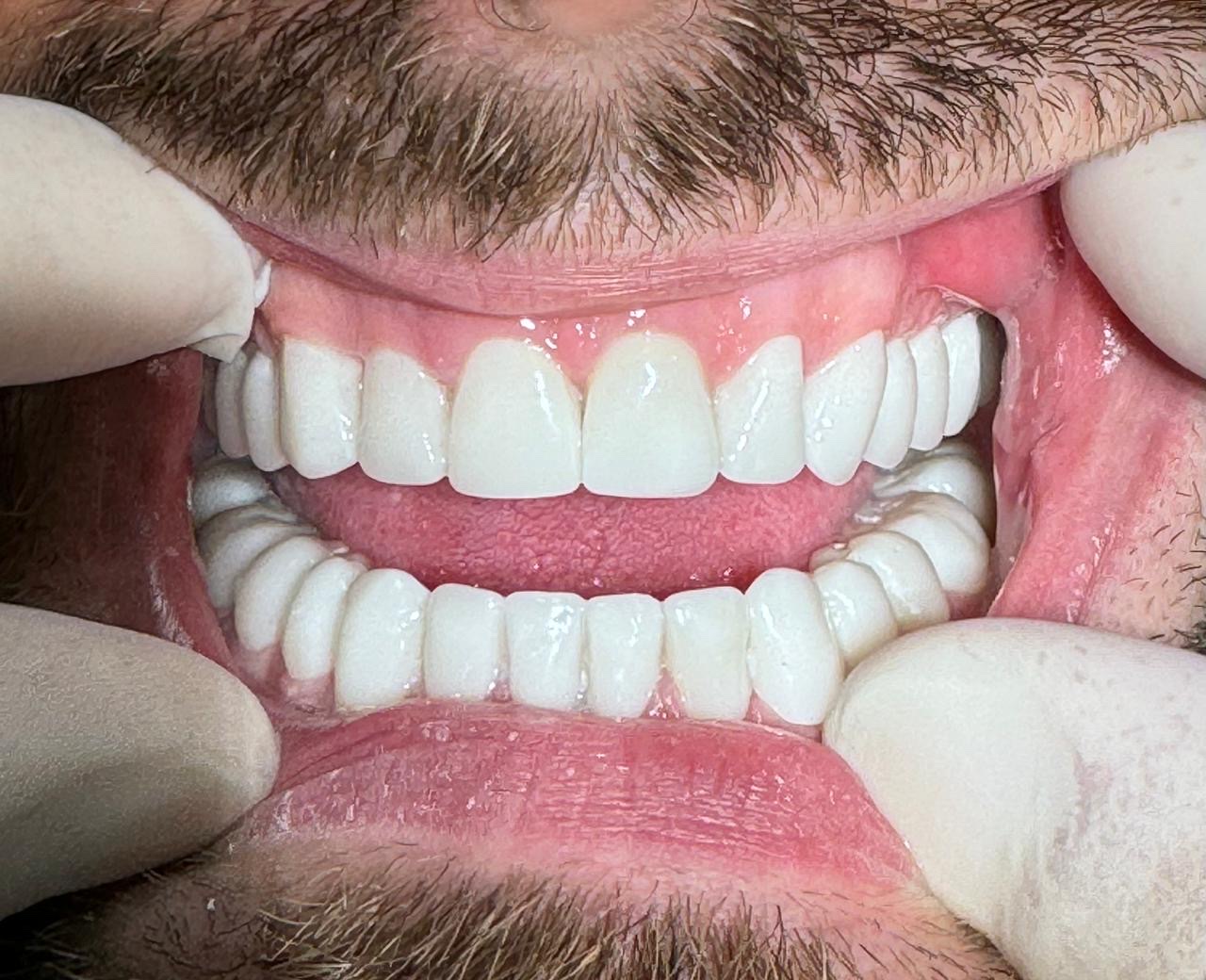 Qato Dental