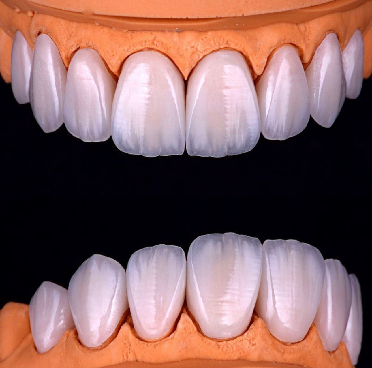 Qato Dental