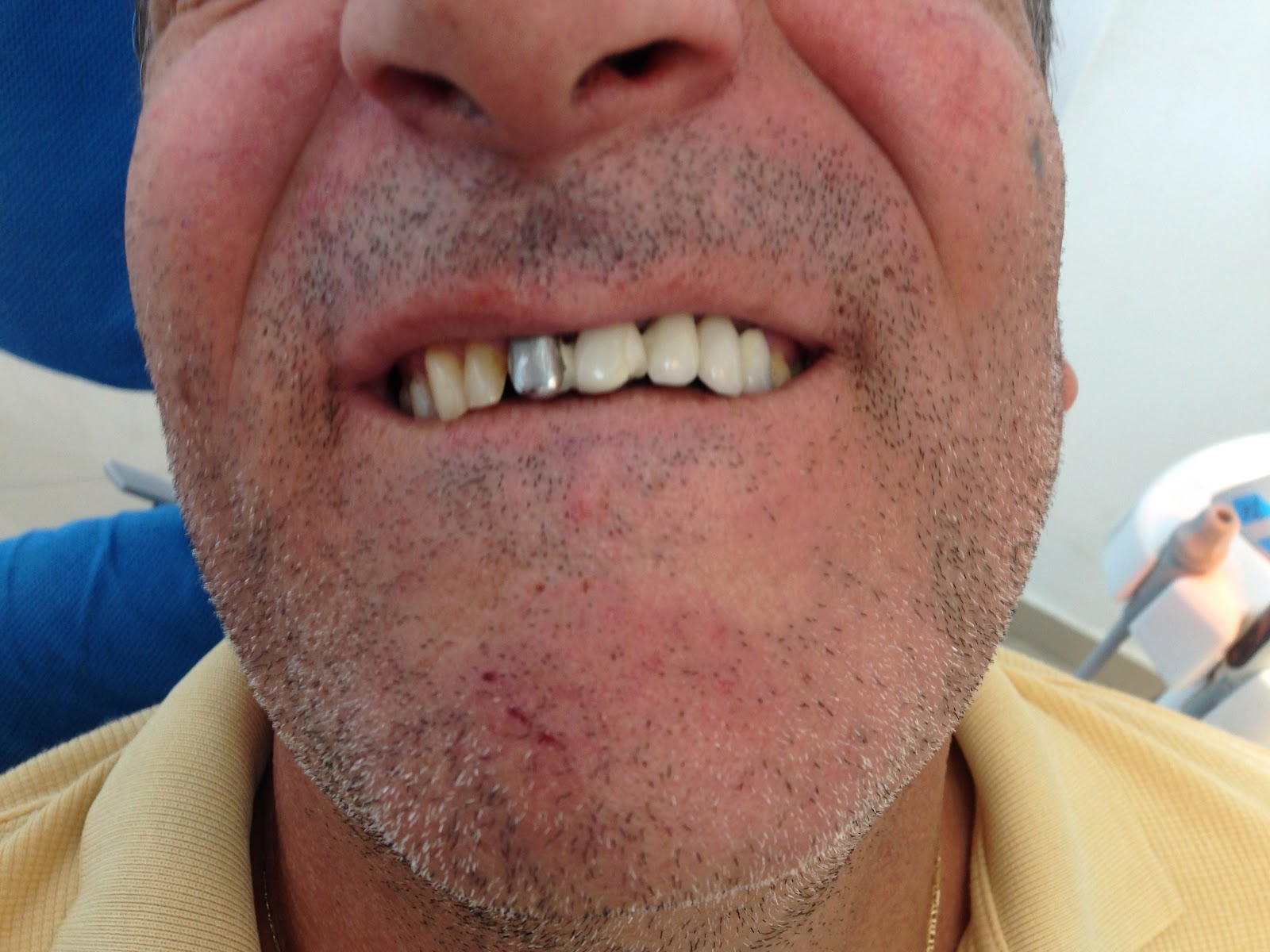 LILAJ DENTAL