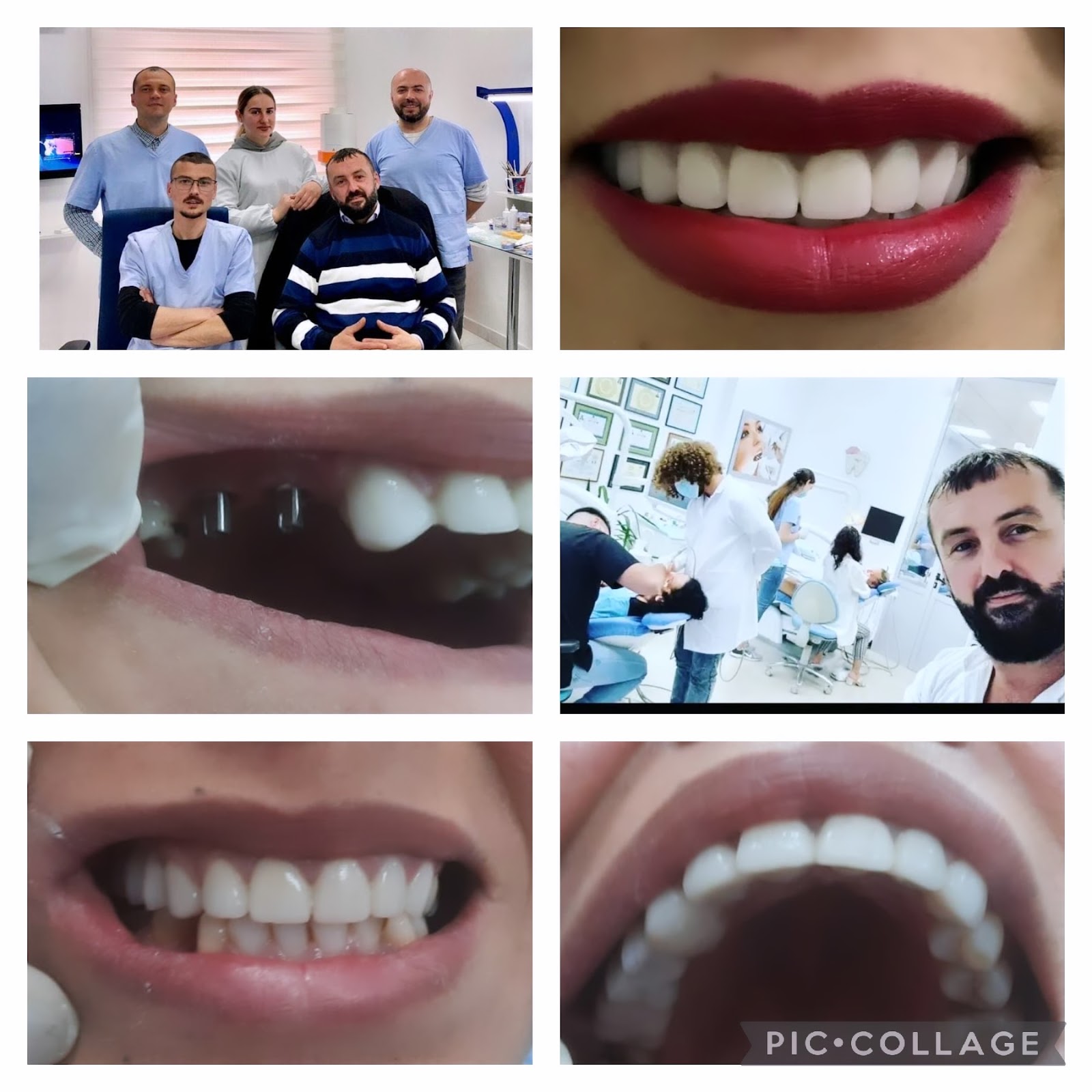 Klinike Dentare "Fatjon Agalliu"