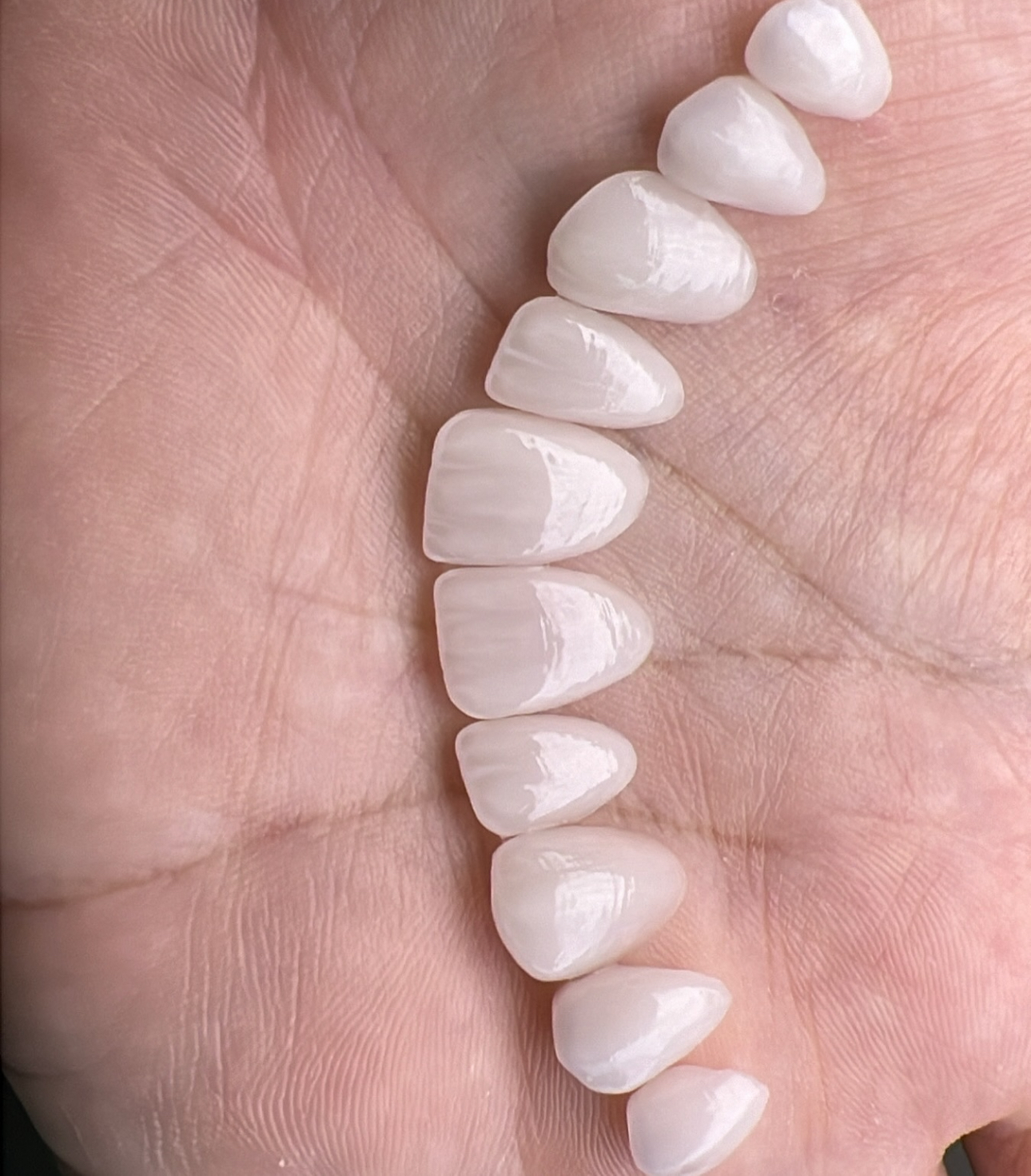 Klinike Dentare Progonati Fier
