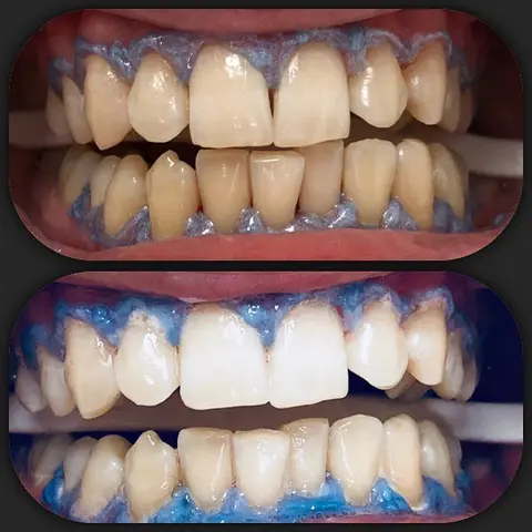 Klinike Dentare - ISUFI ROYAL DENTAL