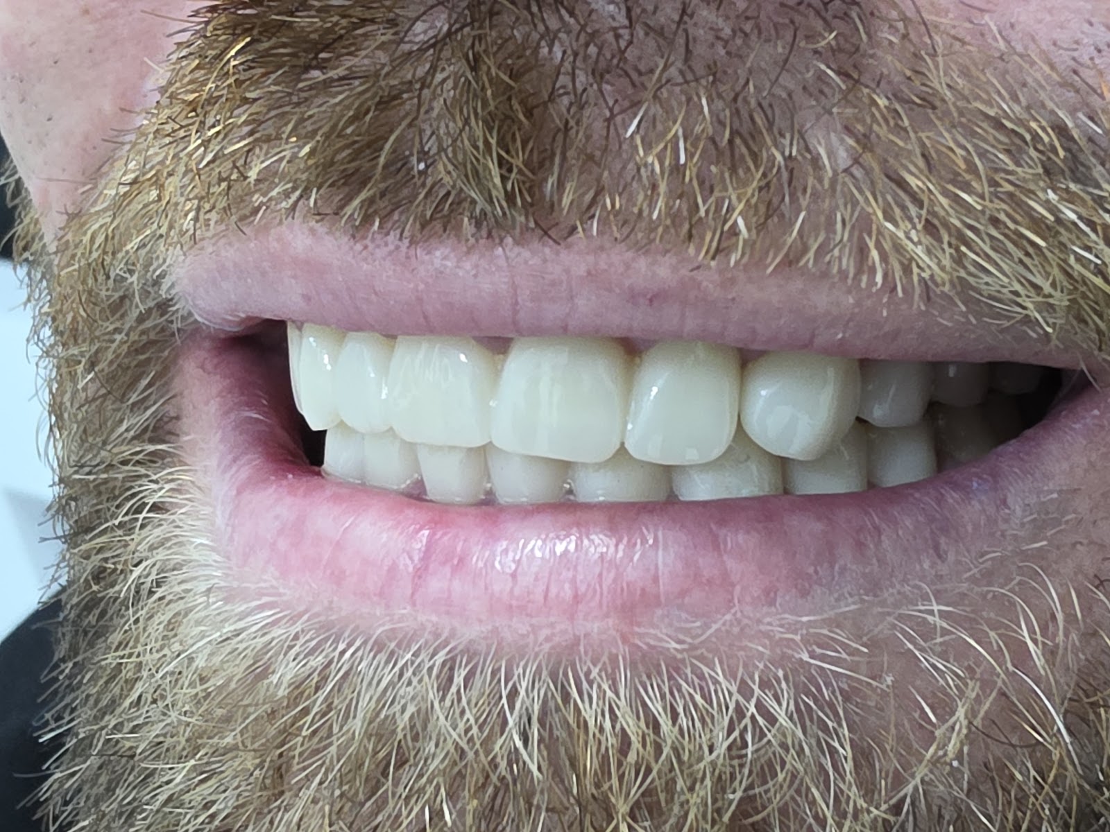 European Dental Clinic (Klinike dentare- Kirurgji-Ortodonci-Pedodonti-Endodonci-Implantologji-Estetike)