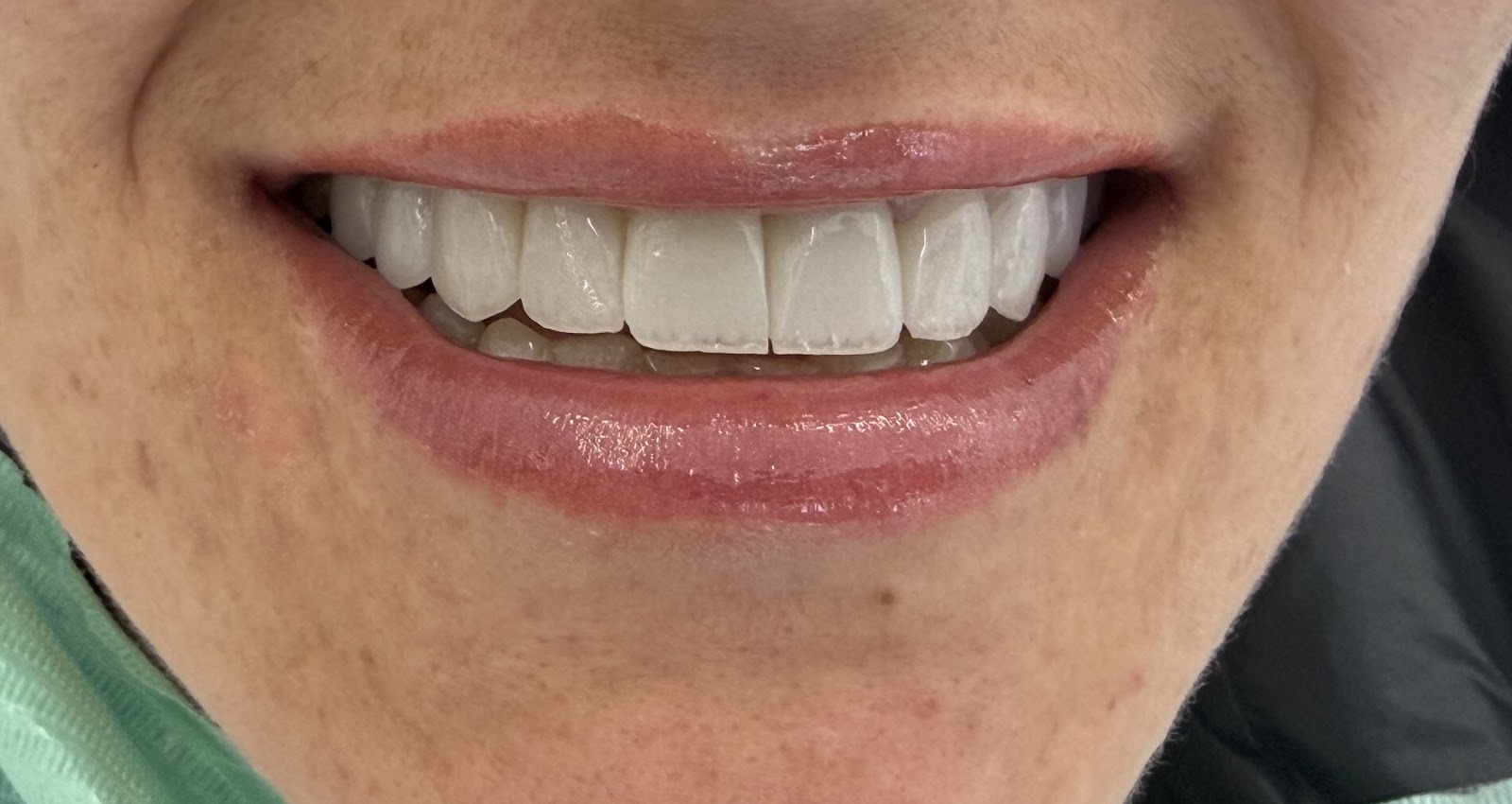 Klinika Dentare “ Dentisti Im” , Kamez