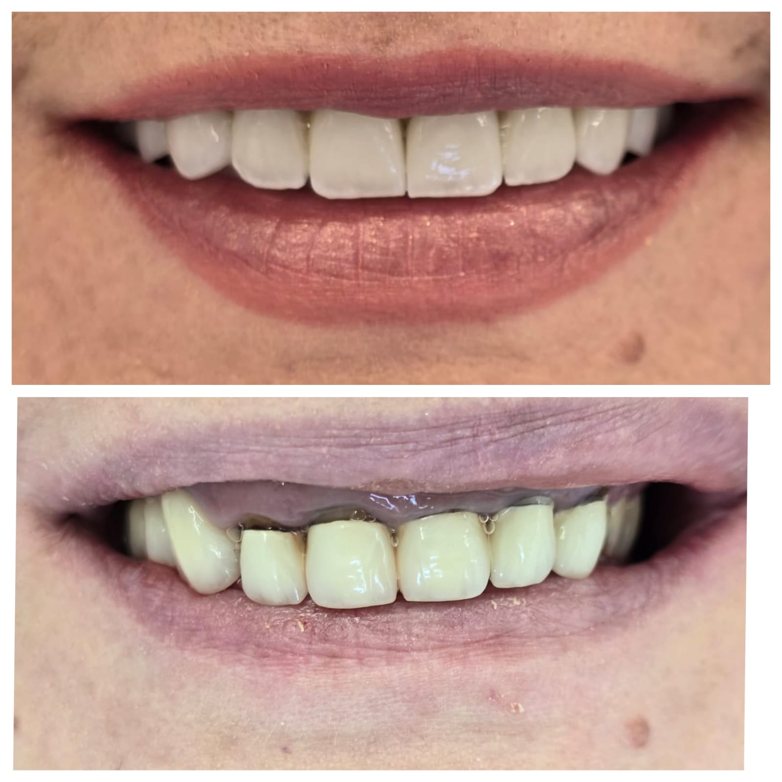 Klinika Dentare “ Dentisti Im” , Kamez