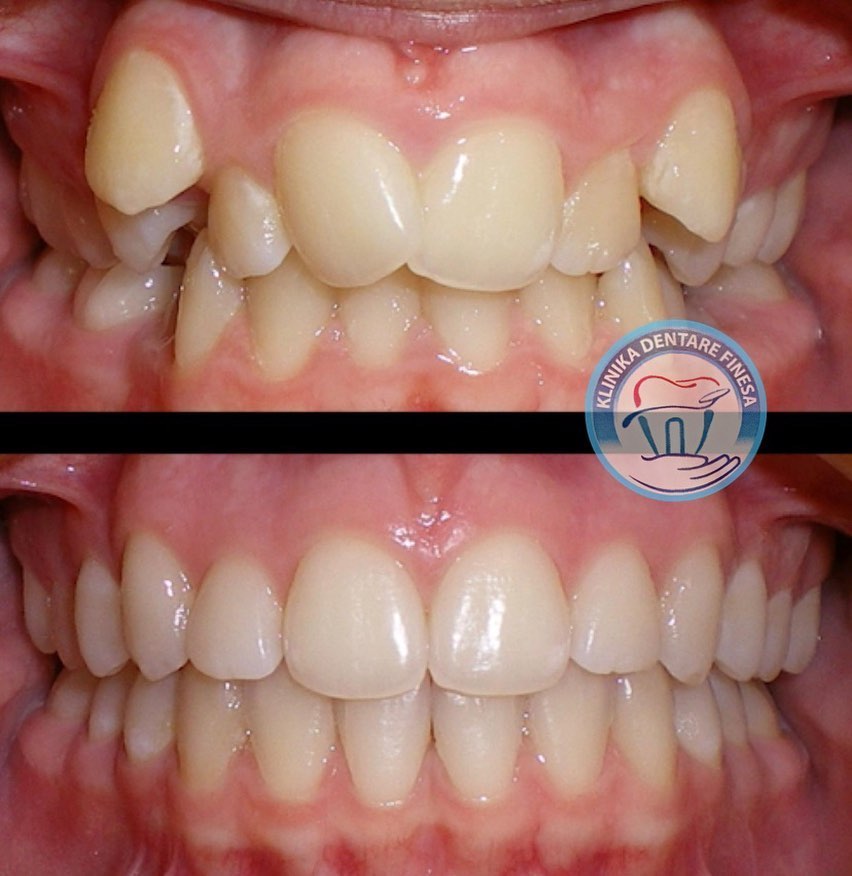 Finesa Dental Clinic | Dentisti in Albania | Aesthetic Dentist | Klinike Dentare ne Tirane