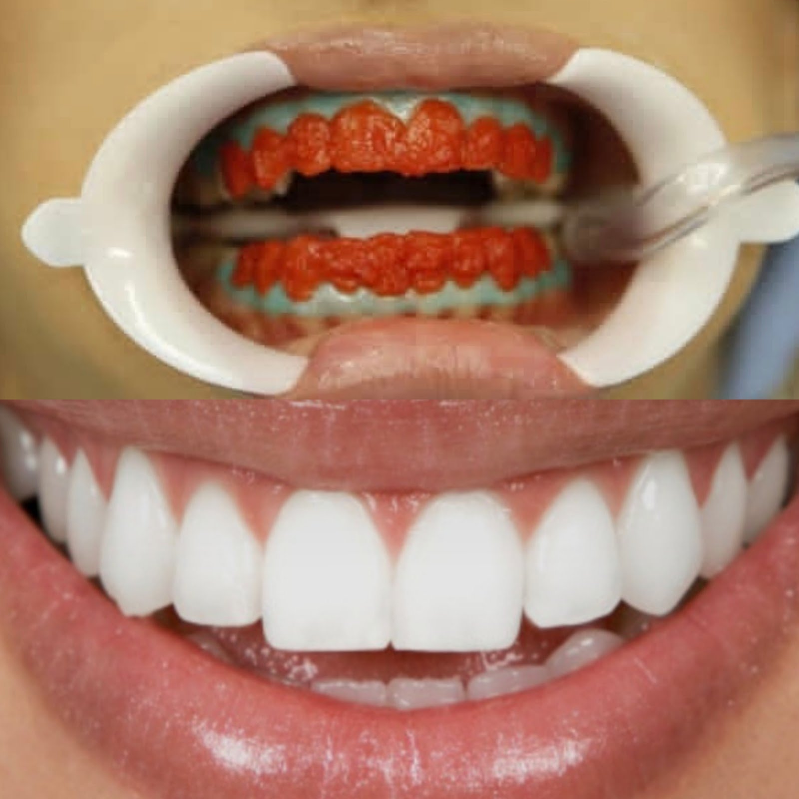 Ami Dental - Dental Clinic in Durrës