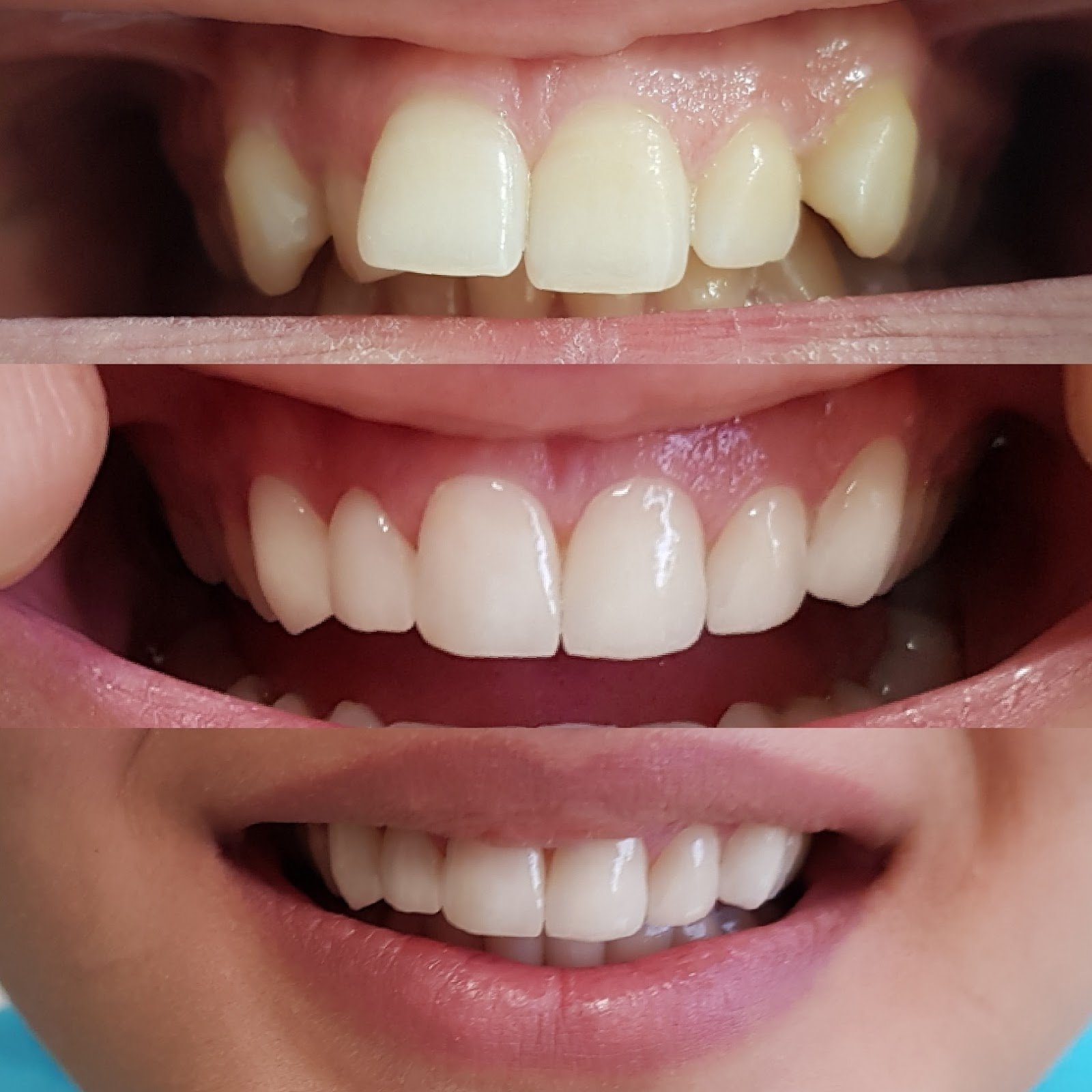 Studio Dentare Ballgjini