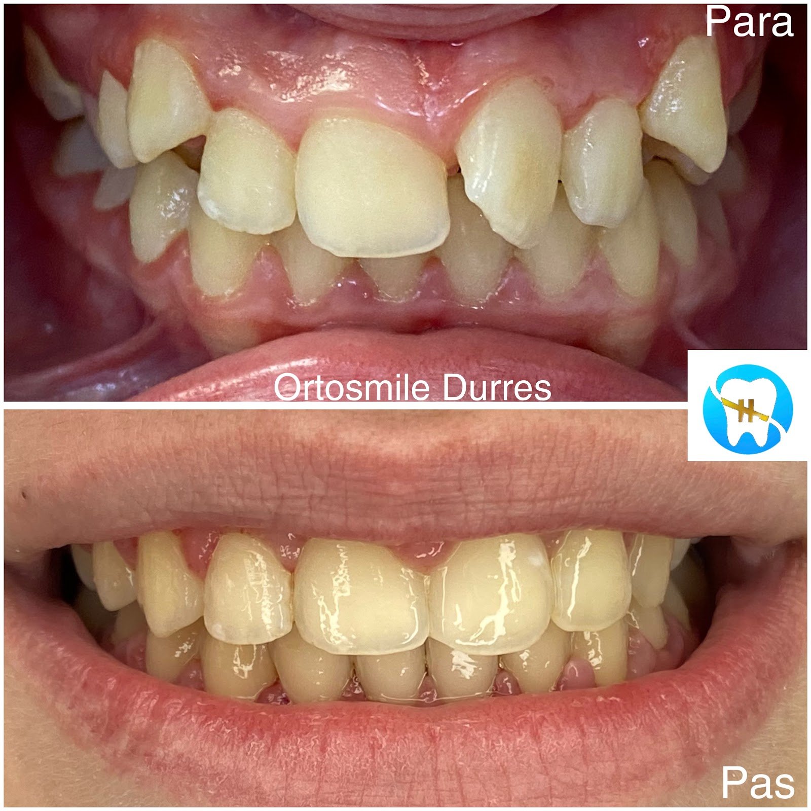OrtoSmile
