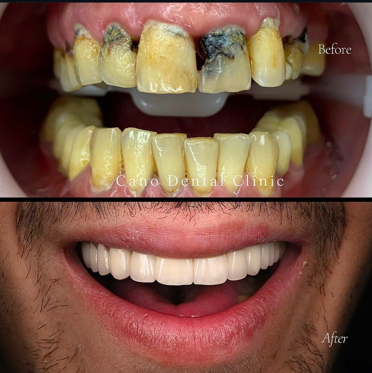 Cano Dental Clinic