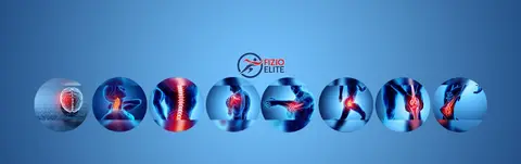 Fizioterapi