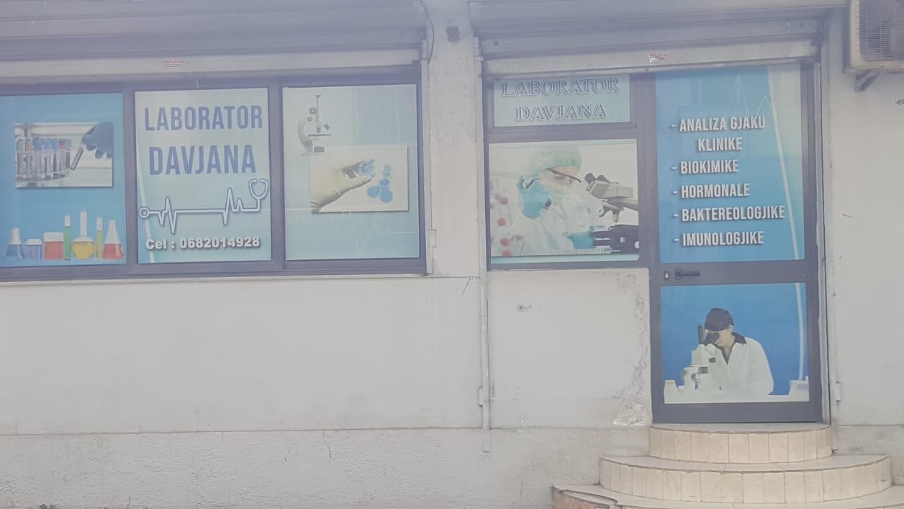 LABORATOR DAVJANA 1 ANALIZA MJEKESORE